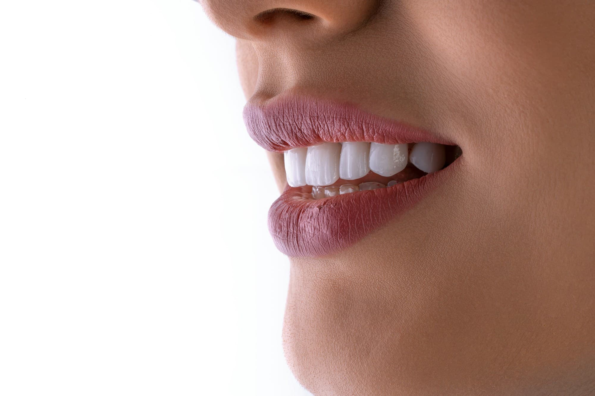 Close-up of an anterior smile